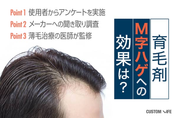 M字ハゲに育毛剤は効果あり 生え際や頭頂部の薄毛におすすめのランキング Customlife カスタムライフ