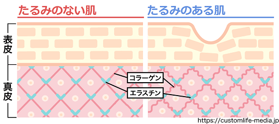 目の下のたるみの原因と解消法 簡単エクササイズ アイクリーム６選 Customlife カスタムライフ