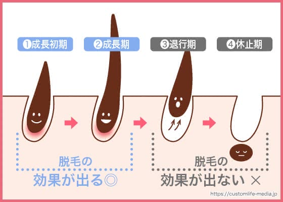 全身脱毛におすすめの脱毛サロン2020｜人気の7社を徹底比較した ...