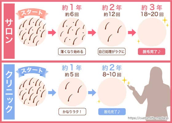 ブライダル,脱毛