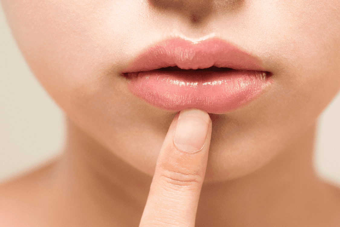 口の周りに変色しやすいのは誰ですか?