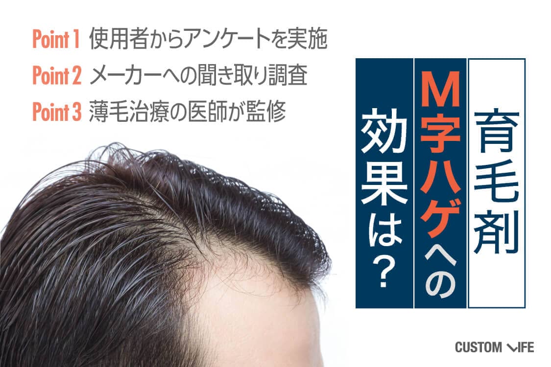 M字ハゲに育毛剤は効果あり 生え際 頭頂部の薄毛対策おすすめランキング Customlife カスタムライフ