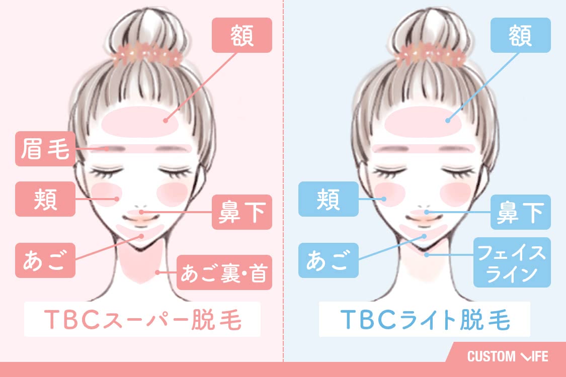 TBCスーパー脱毛は額、眉毛、頬、あご、鼻下、顎裏、首。TBCライト脱毛は額、頬、あご、鼻下、フェイスライン