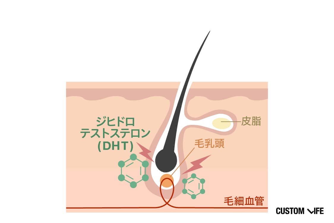 抜け毛が起こるメカニズムの画像
