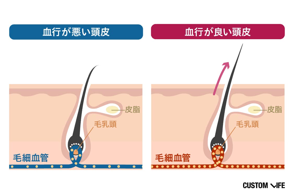 血行が悪い頭皮と血行が良い頭皮