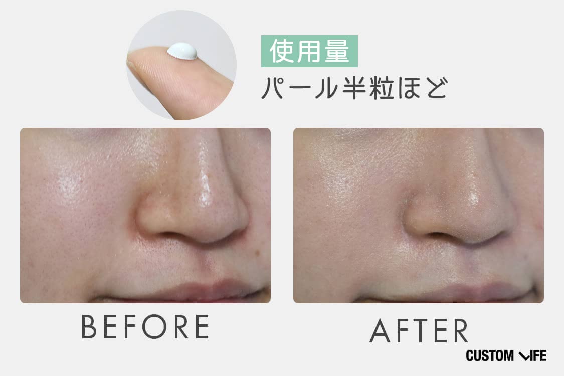 赤み消し