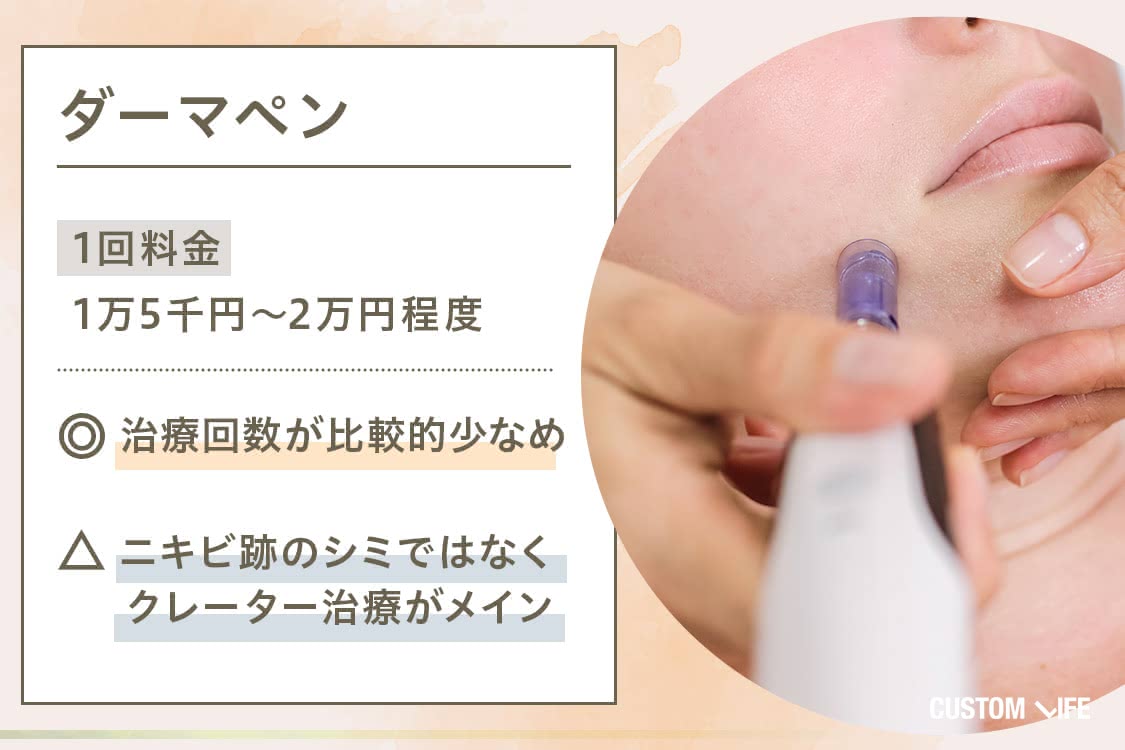 ニキビ シミ ニキビ跡 消す 治療 ダーマペン 美容皮膚科