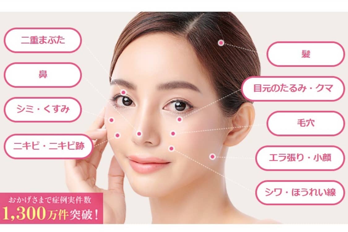 ニキビ シミ レーザートーニング 品川美容外科