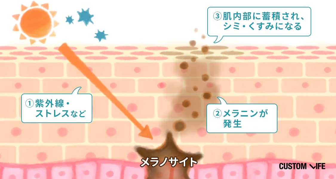 美白 美容液 シミができるカニズム