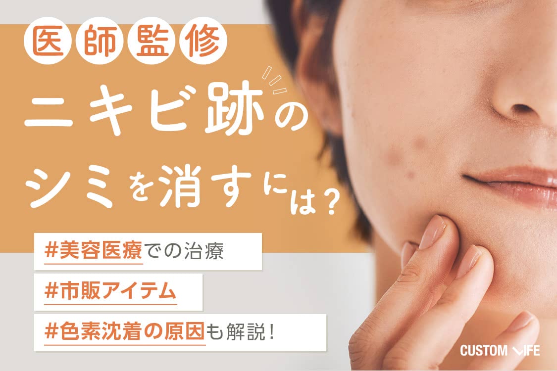 ニキビ シミ 消す