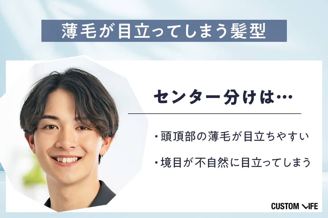 薄毛,髪型