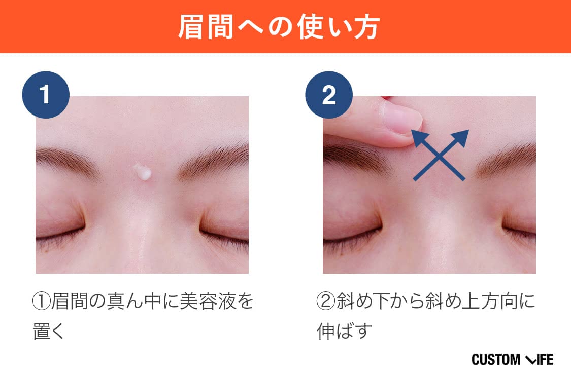 リンクルショットメディカルセラムNの眉間への使い方