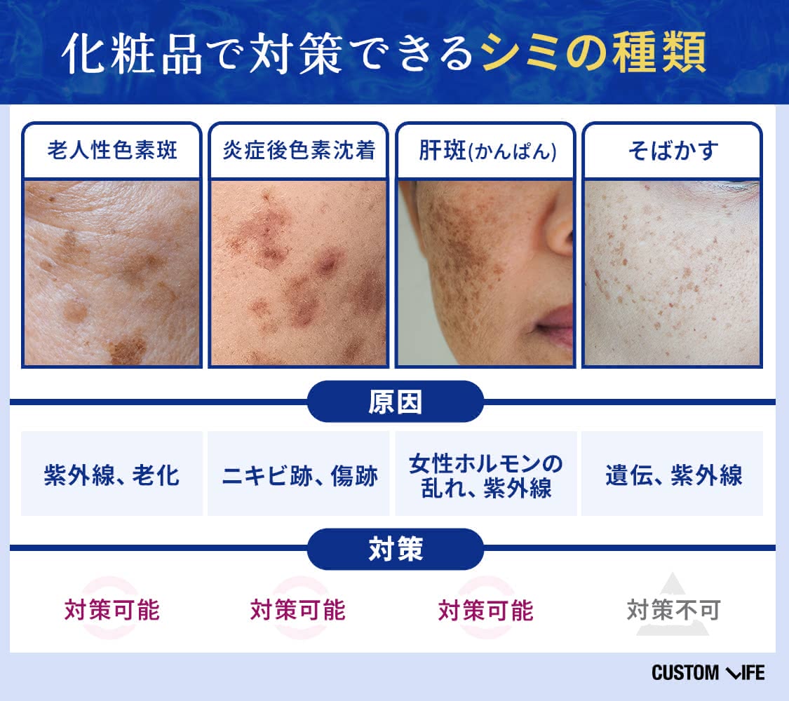 化粧品で対策できるシミの種類一覧