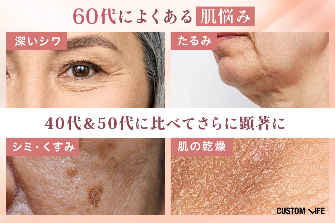 60代によくある肌悩みのイメージ画像