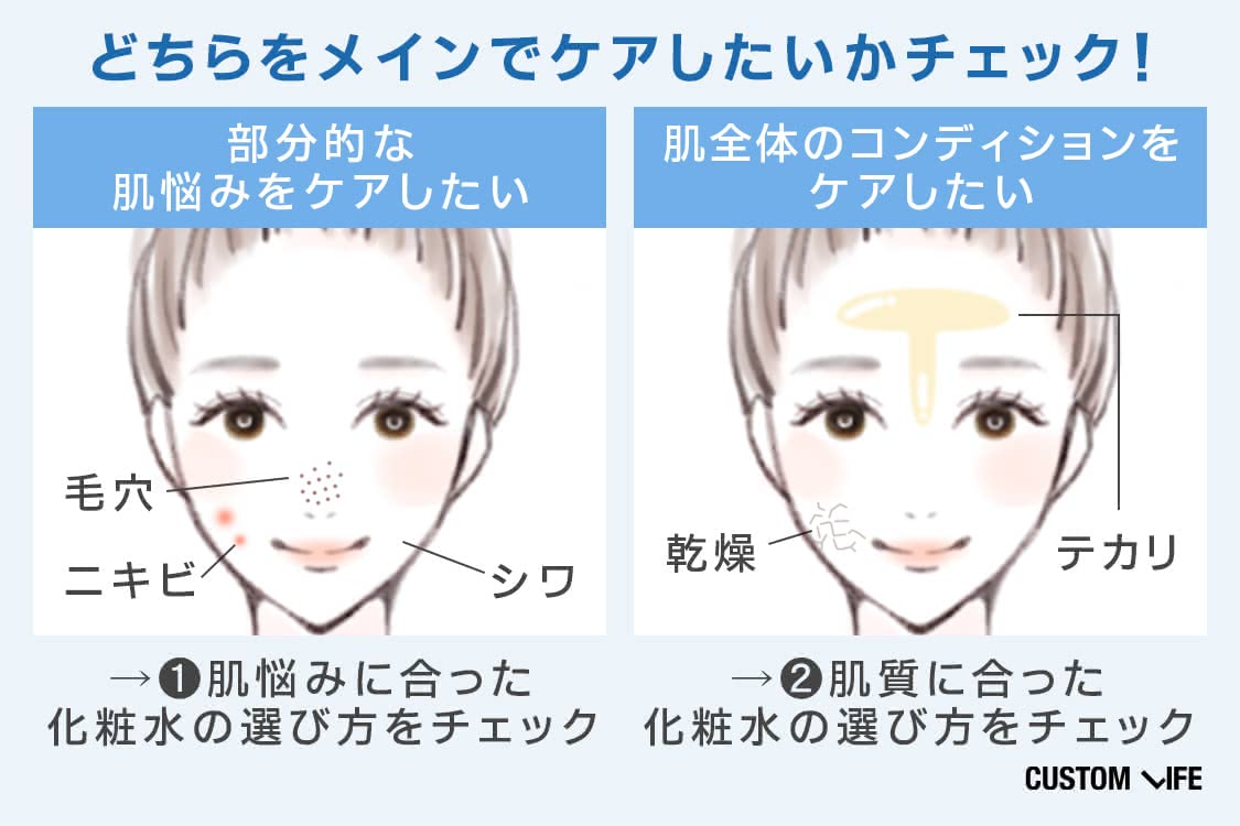 化粧水選びのポイント