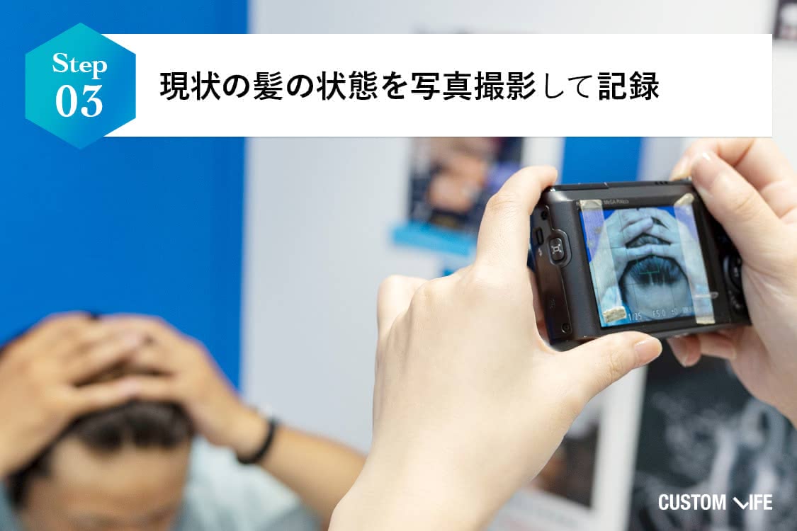 頭皮の撮影