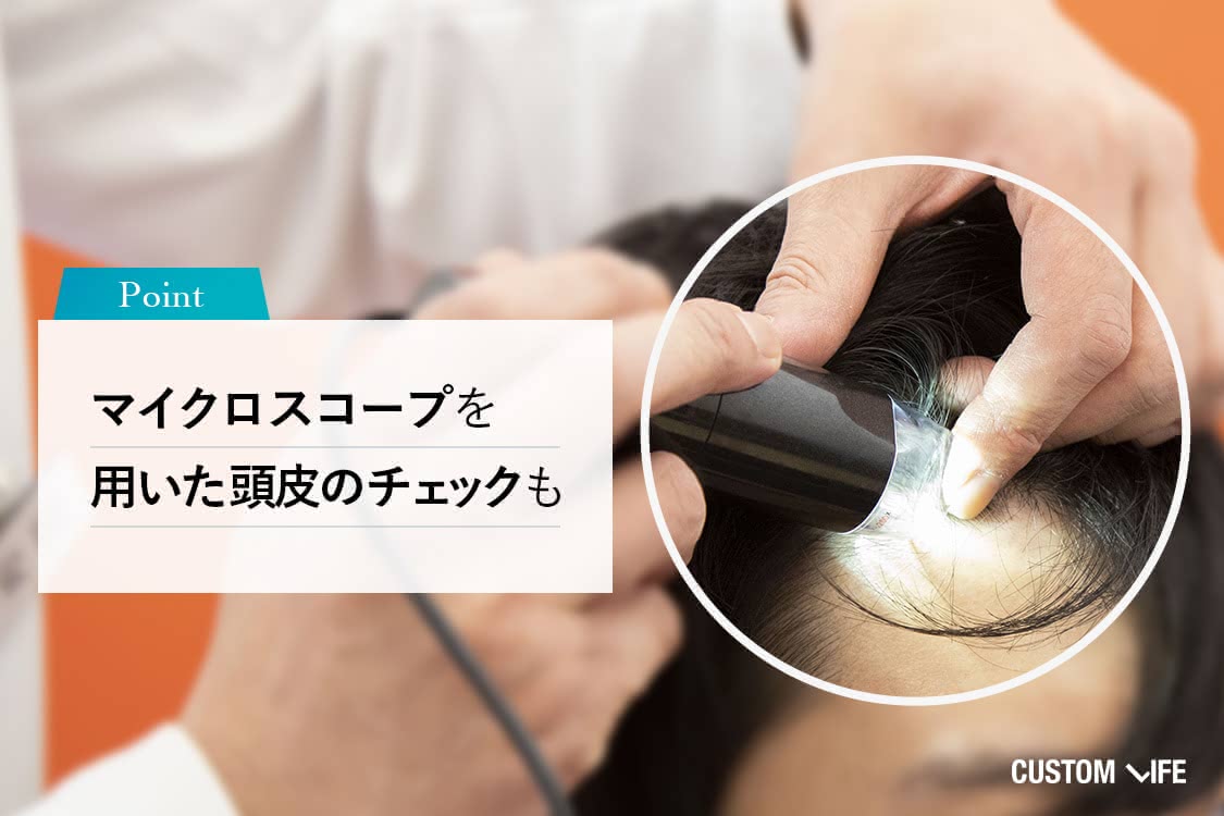 マイクロスコープで生え際をチェック