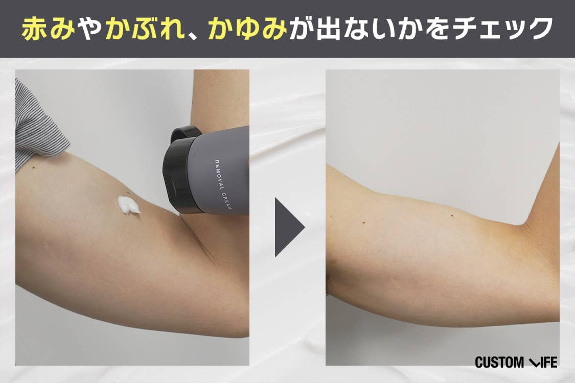 ヒゲ脱毛,クリーム