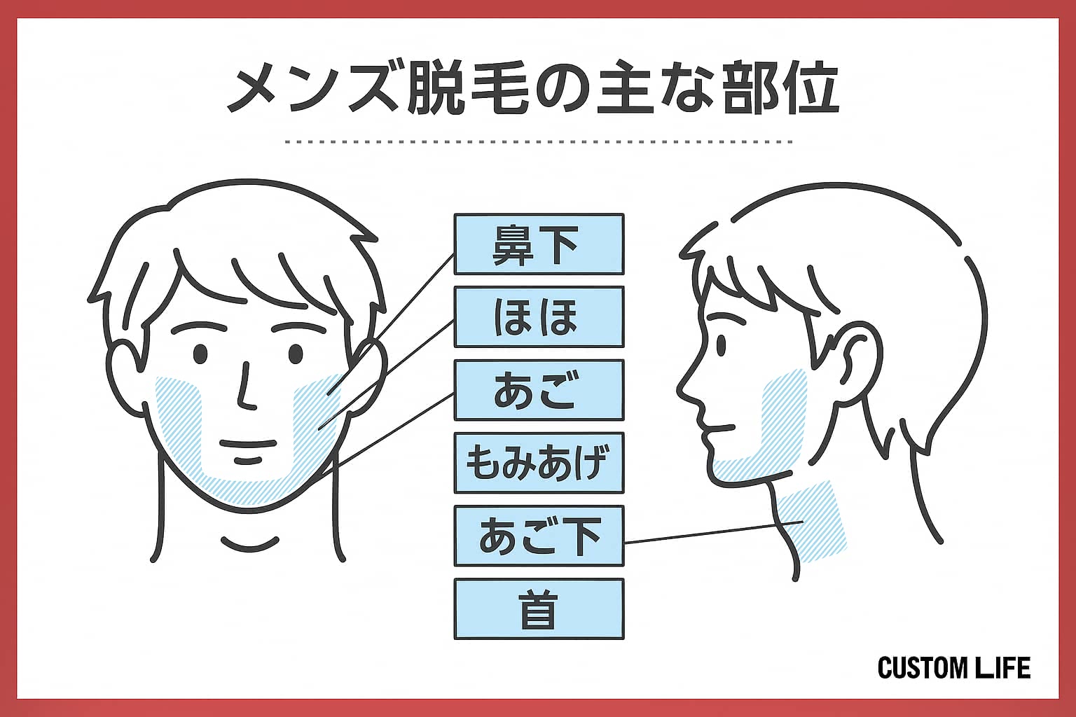 メンズ医療脱毛,名古屋