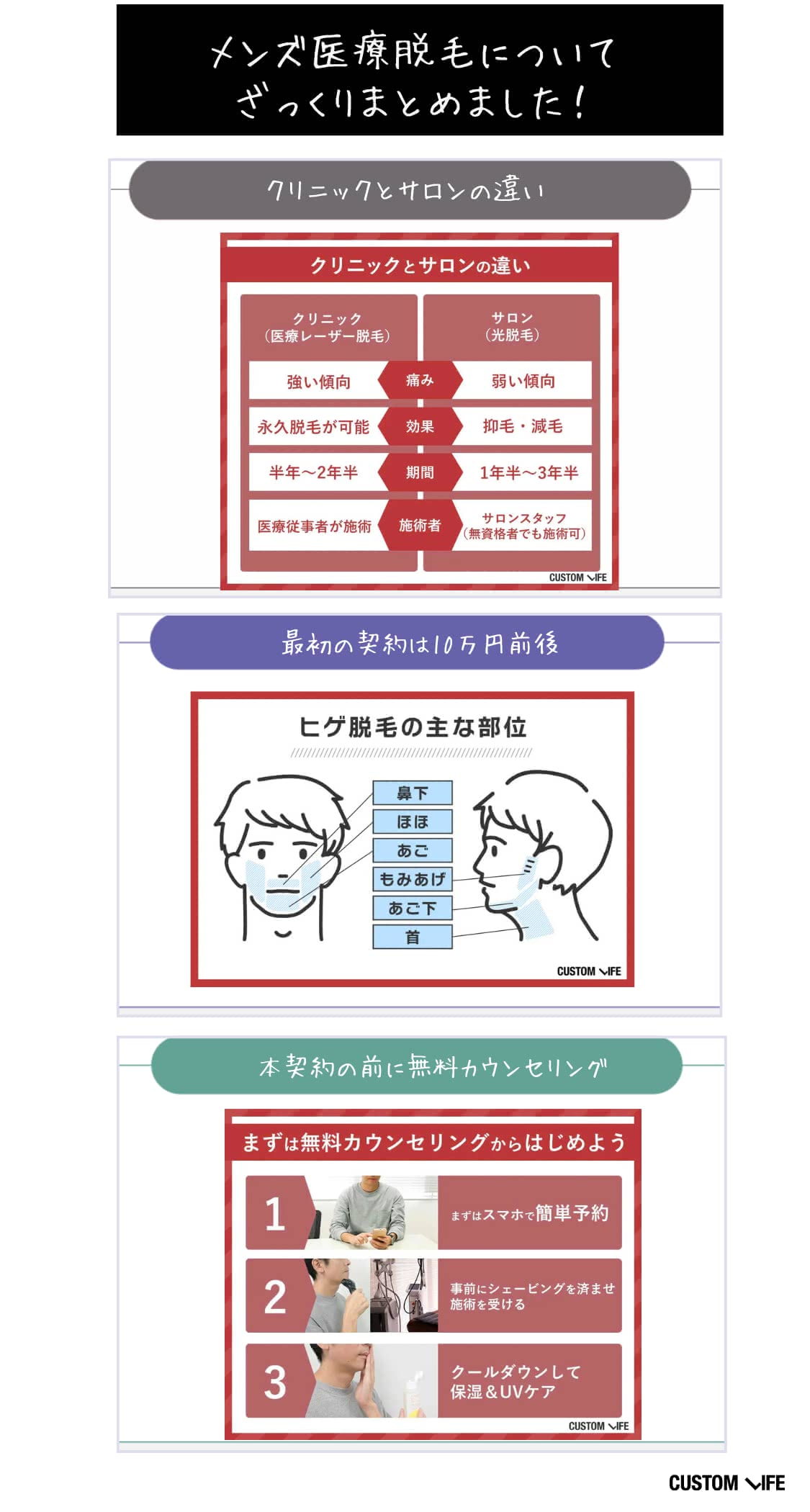ヒゲ脱毛,名古屋