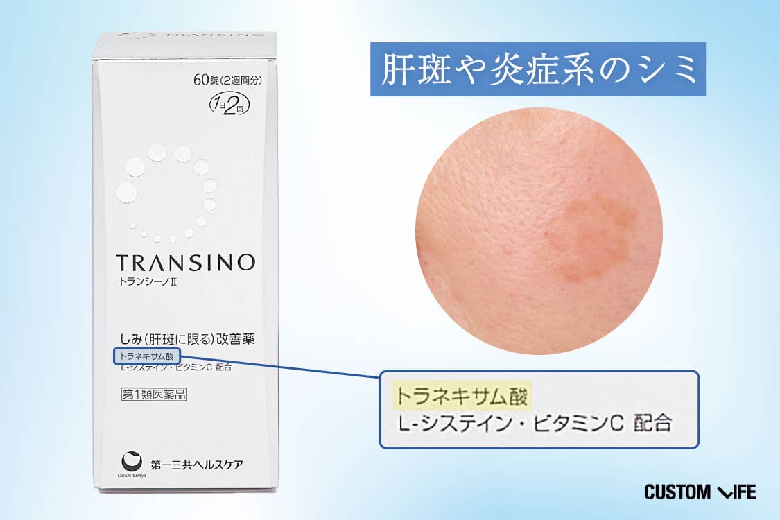 シミ 飲み薬の選び方①肝斑や炎症系のシミは「トラネキサム酸」配合がおすすめ