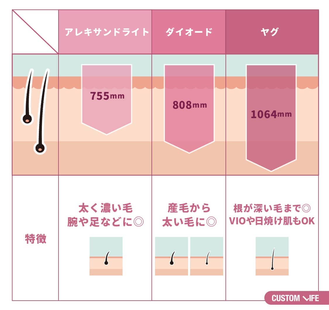 医療脱毛,東京