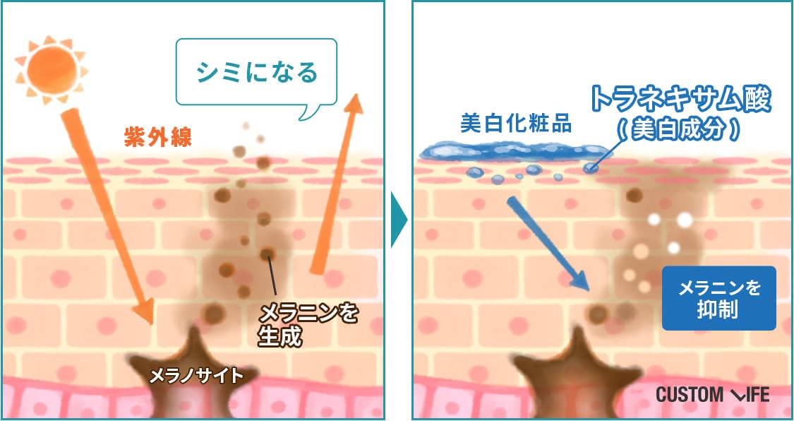トラネキサム酸化粧水 美白効果のメカニズム解説画像