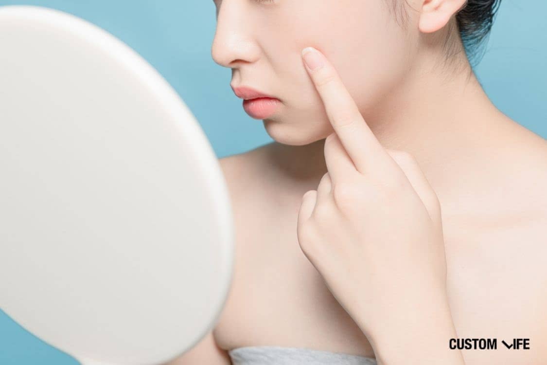 トラネキサム酸 化粧水 QA トラネキサム酸は肌に優しい？