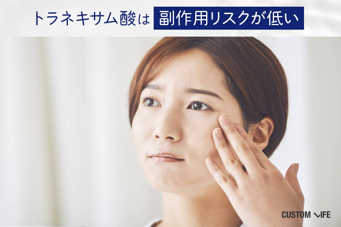 トラネキサム酸化粧水の副作用