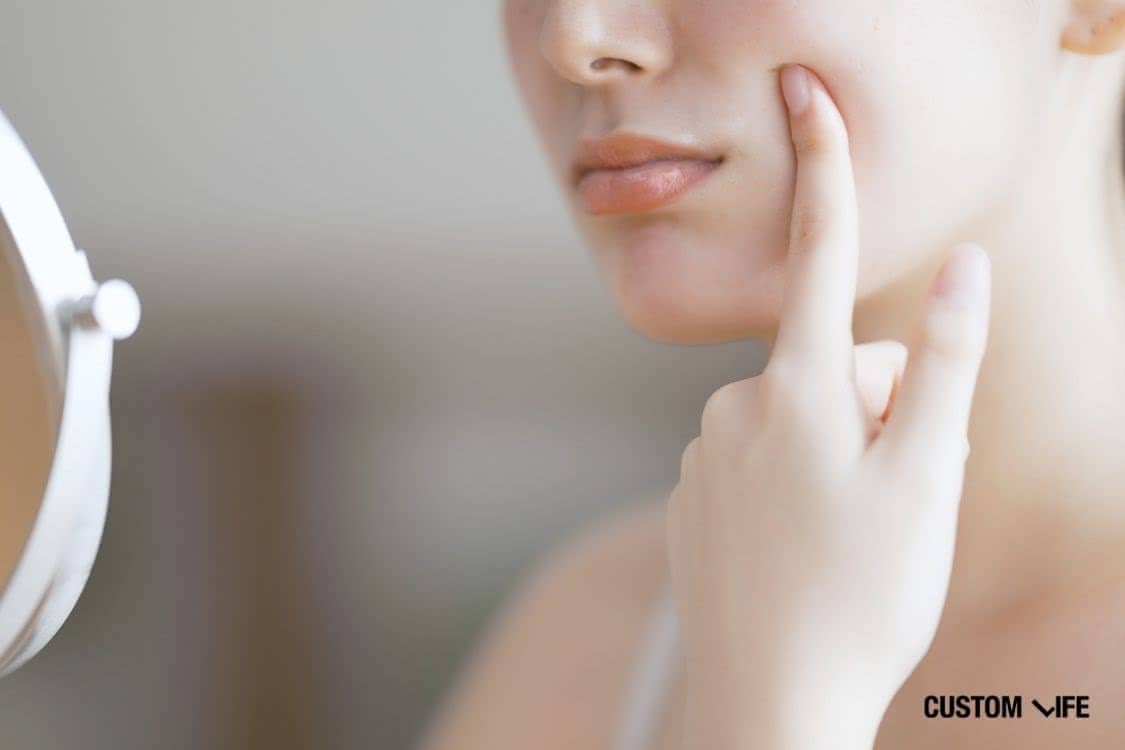 シナール,効果 Q1. シナールは肌綺麗になりますか？