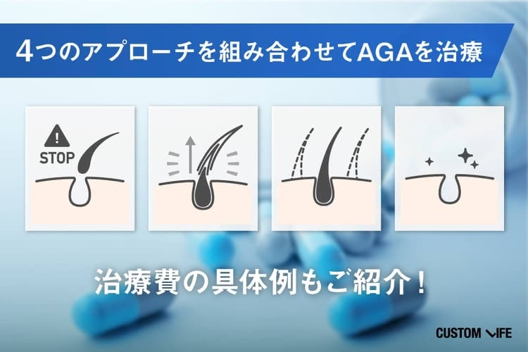 4つのアプローチを組み合わせてAGAを治療