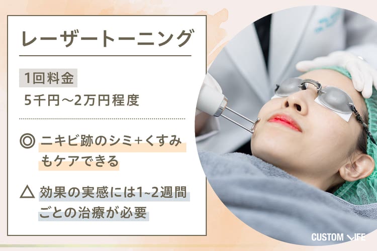 ニキビ シミ ニキビ跡 消す 治療 レーザートーニング 美容皮膚科