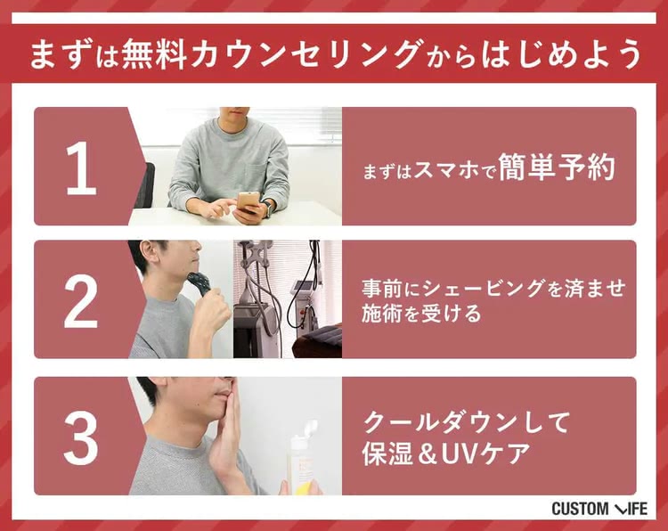 ヒゲ脱毛,体験
