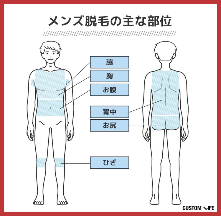 メンズ医療脱毛,大阪