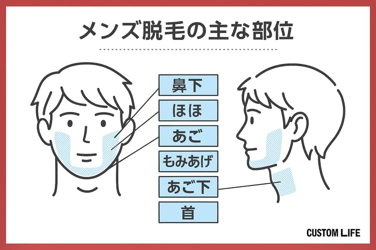 メンズ医療脱毛,大阪