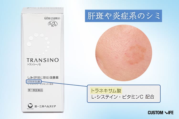 シミ 飲み薬の選び方①肝斑や炎症系のシミは「トラネキサム酸」配合がおすすめ