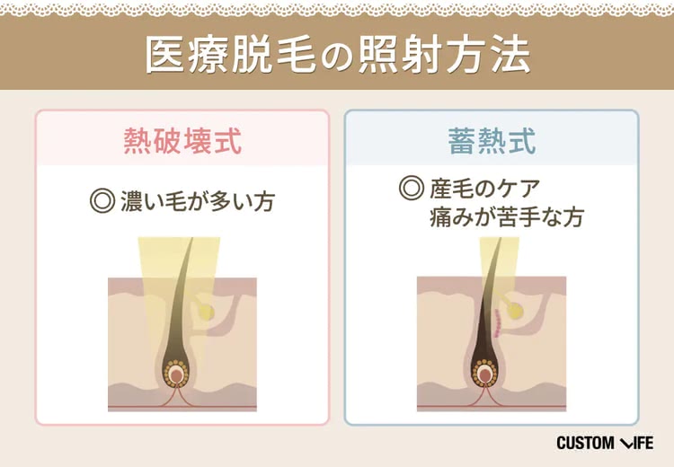 医療脱毛,長野