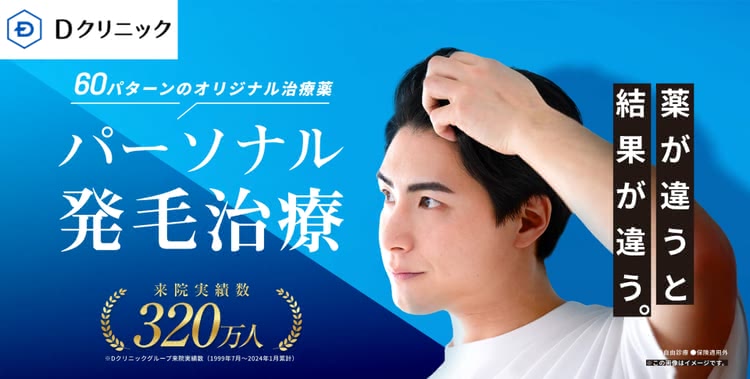 AGA治療 おすすめ