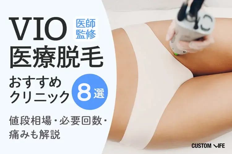 VIOとは